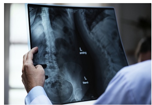 doctor examining x-ray of spine in clinical setting
